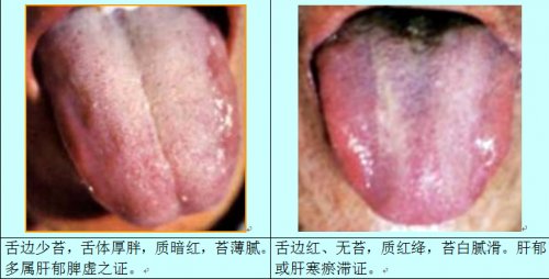 肝胆舌1.jpg