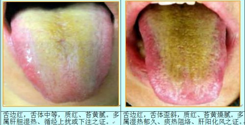 肝胆舌2.jpg