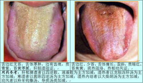 肝胆舌3.jpg