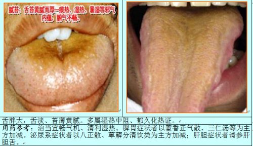 湿热舌1.jpg