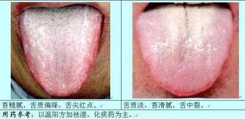 痰湿舌2.jpg