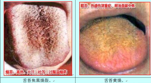 燥热舌1.jpg