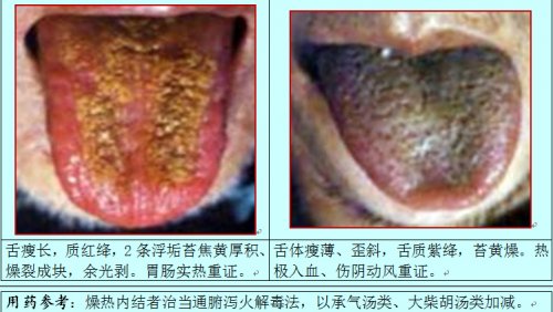 燥热舌2.jpg
