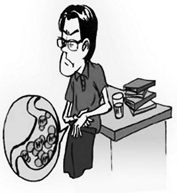 反流性胃炎4.jpg