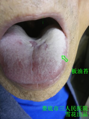 板油苔.jpg
