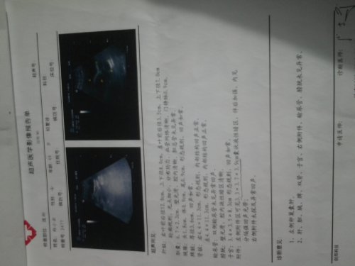 20141116_121427.jpg