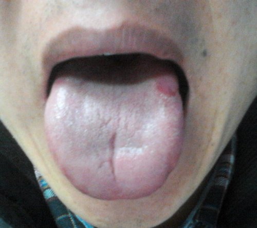 20150108_191310.jpg