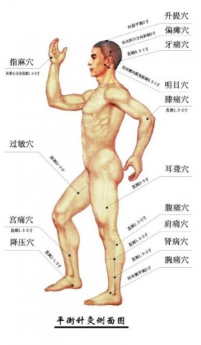 平衡针灸穴位图1.jpg
