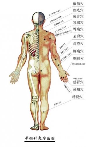 平衡针灸穴位图2.jpg