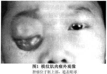 u=2562859020,3319658584&amp;amp;fm=23&amp;amp;gp=0.jpg