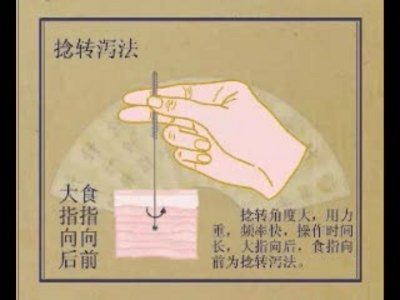 捻转泻法.jpg