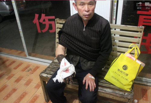 莫明贤蛇伤.1png.png