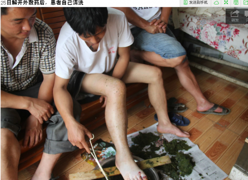 蛇伤.2png.png