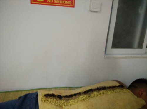 4.长蛇灸中.jpg