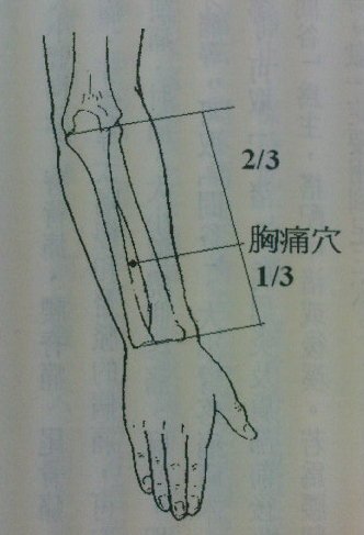 胸痛穴.jpg