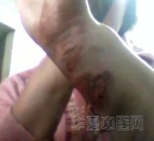 烫15.jpg