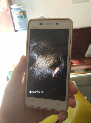 半年后头发.jpg