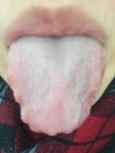 舌诊2017110402.jpg